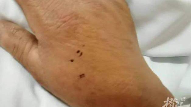 外媒爆料：前河北外援拉维齐上月试图拿剪刀自残，受伤被送医院